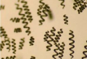 Spiruline microscope