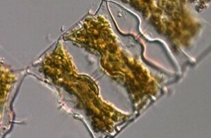 Ondatella aurita microscope